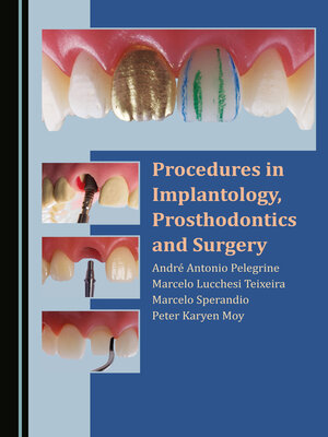 cover image of Procedures in Implantology, Prosthodontics and Surgery